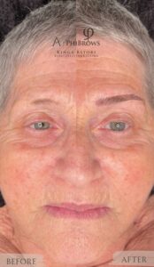 idős női szemöldök korrekció