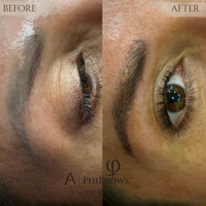 szmeöldöktetvolás javítása